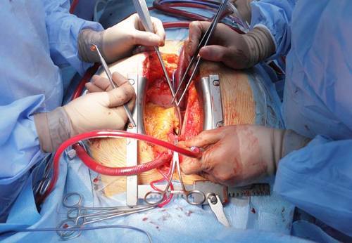 Cardiology and Cardiac Surgery